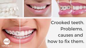 How do braces work for crowded teeth? Crooked Teeth Causes Problems And How To Fix Them Method Dental