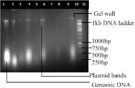 genomic dna extraction on agarose gel