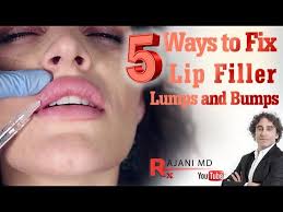 how to fix lip filler ps and lumps