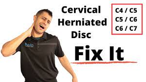 cervical herniated disc exercises you