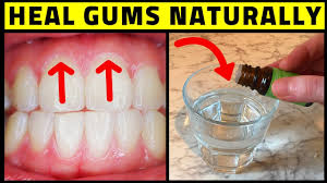 cure periodontal disease at home heal