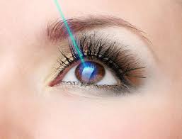 recover from lasik surgery