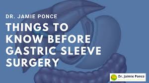 gastric sleeve surgery jaime ponce