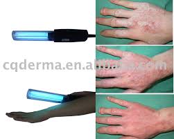 Psoriasis Uv Lamp Home Diy Leather Lamp Shade What To