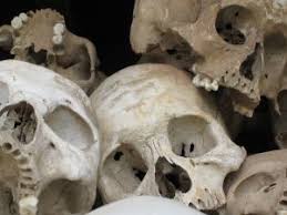 Image result for Study of Skeletal Remains: Solving a Homicide Case