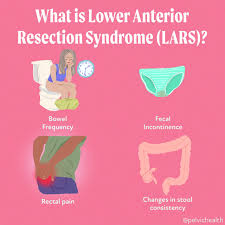 low anterior resection surgery