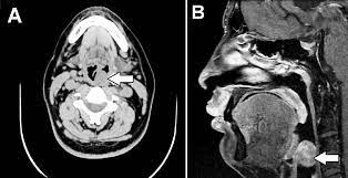 the sagittal view of mri of the head