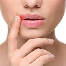 how to treat a cold sore forefront