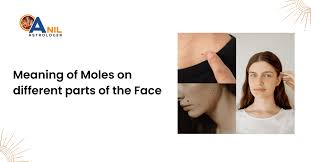 moles on diffe parts of the face