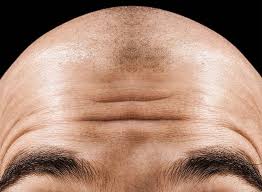Geheimratsecken sind das erste anzeichen für einen erblich bedingten haarausfall. Die Besten Frisuren Fur Geheimratsecken L Oreal Men Expert