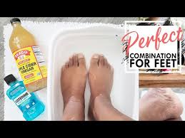 vinegar foot soak listerine foot bath