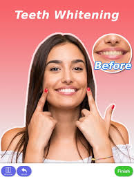 perfect smile teeth whitening on the