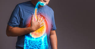 Say Goodbye to Acid Reflux: Effective Ways to Prevent and Manage It - Gastromed Healthcare