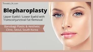 blepharoplasty upper eyelid lower