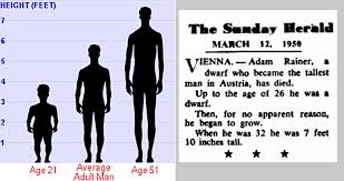 Adam Rainer The Only Person In History To Be Both A Dwarf
