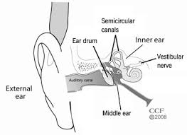 Ménière's disease is a disorder of the inner ear that causes severe dizziness (vertigo), ringing in the ears (tinnitus), hearing loss, and a feeling of fullness or congestion in the ear. Canalith Repositioning Procedure Crp