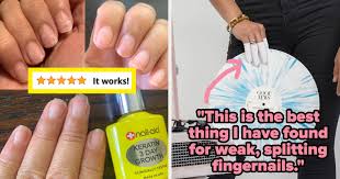 19 best nail biting deters to kick