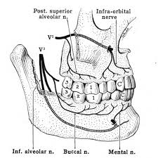 trigeminal nerve and wisdom teeth