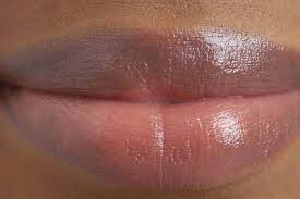 the problem of dark lips fitness health