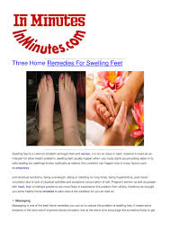 home remes for swelling feet