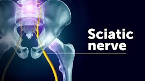 sciatic nerve pain