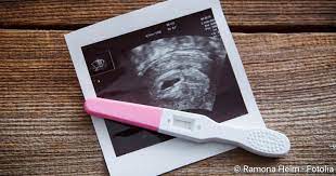 Manche schwangerschafttstests, die sogenannten schwangerschaftsfrühtests, können laut hersteller schon fünf bis sechs tage vor der menstruation. Schwangerschaftstest Ab Wann Er Aussagekraftig Ist Netdoktor At