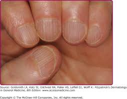 biology of nails and nail disorders