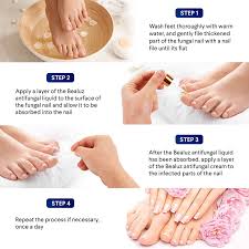 nail fungus treatment for toenail