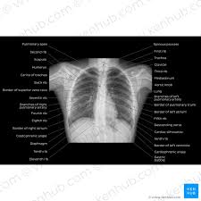 Because some conditions of the chest. Anatomy X Ray Anatomy Drawing Diagram
