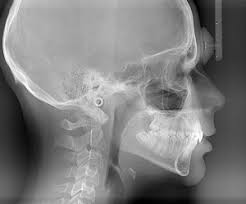 Image result for x rays in dentistry