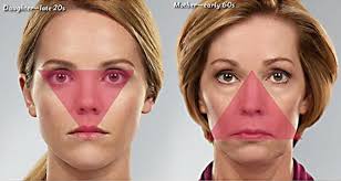 are midface dermal fillers for the eyes