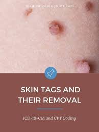 code for skin s and their removal