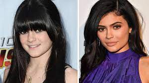 Kylie jenner net worth is more than $900 million. Kylie Jenner Before And After Check Out The Youngest Kardashian Sister S Rumoured Capital