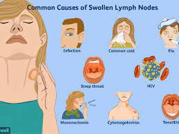 What does cancer in a lymph node mean? How To Tell A Lump From A Lymph Node