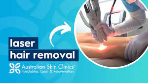 laser hair removal australian skin