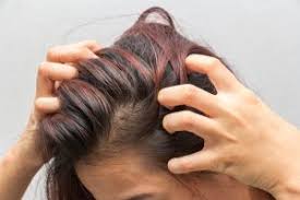 how to ease an itchy dry scalp crave