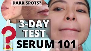 Update your location to get accurate prices and availability. Solusyon Sa Dark Spots At Pimple Marks Garnier Vitamin C Serum Review Kath Melendez Youtube