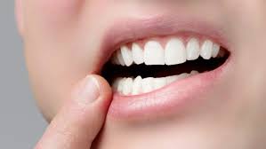 Es fühlt und ertastet mit dem mund. Wann Und Wo Wachst Der Erste Zahn Praxis Fur Zahnmedizin