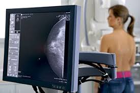 mammography screening ile ilgili görsel sonucu