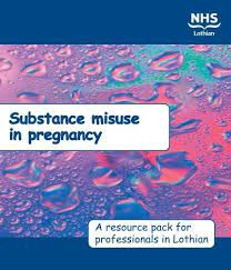 substance misuse in pregnancy nhs lothian