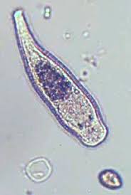 microscopic pond life