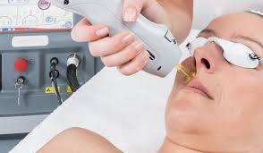 انواع اجهزة الليزر لازالة الشعر في العيادات المؤجَّلَة