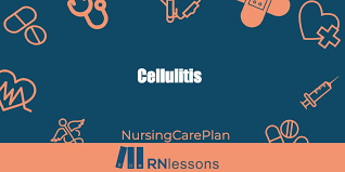cellulitis nursing diagnosis care