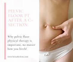 recover your pelvic floor after a c section