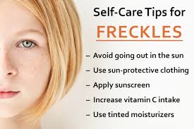 how to lighten and fade freckles 4