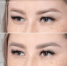 permanent makeup removal my cms