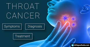 The most common sign of throat cancer is a sore throat. 10 Symptoms Of Throat Cancer You Mustn T Ignore India