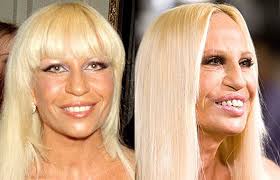donatella versace before and after