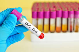 Mch Levels In Complete Blood Count Tests High And Low Levels
