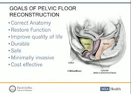 pelvic floor reconstruction in the mesh era